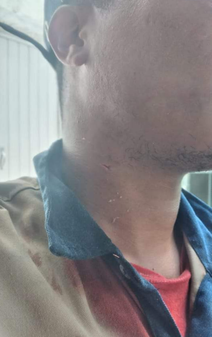 Ataque sufrido por contratista de Acuacar por un usuario, es rechazado por Aguas de Cartagena.